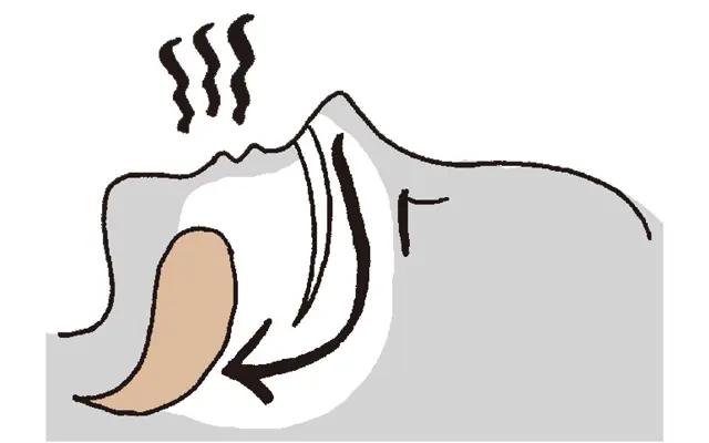 舌やのどの筋緊張低下がいびきを起こすメカニズム2