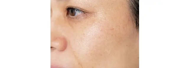 こんなことが不安で、 クリニックのシミとりに 二の足を踏んでいます