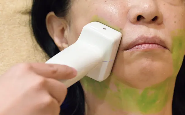 《2》1カ所5分間、機器を当てる。低温からスタートし、45℃前後まで上げていく。計30分ほどで終了。