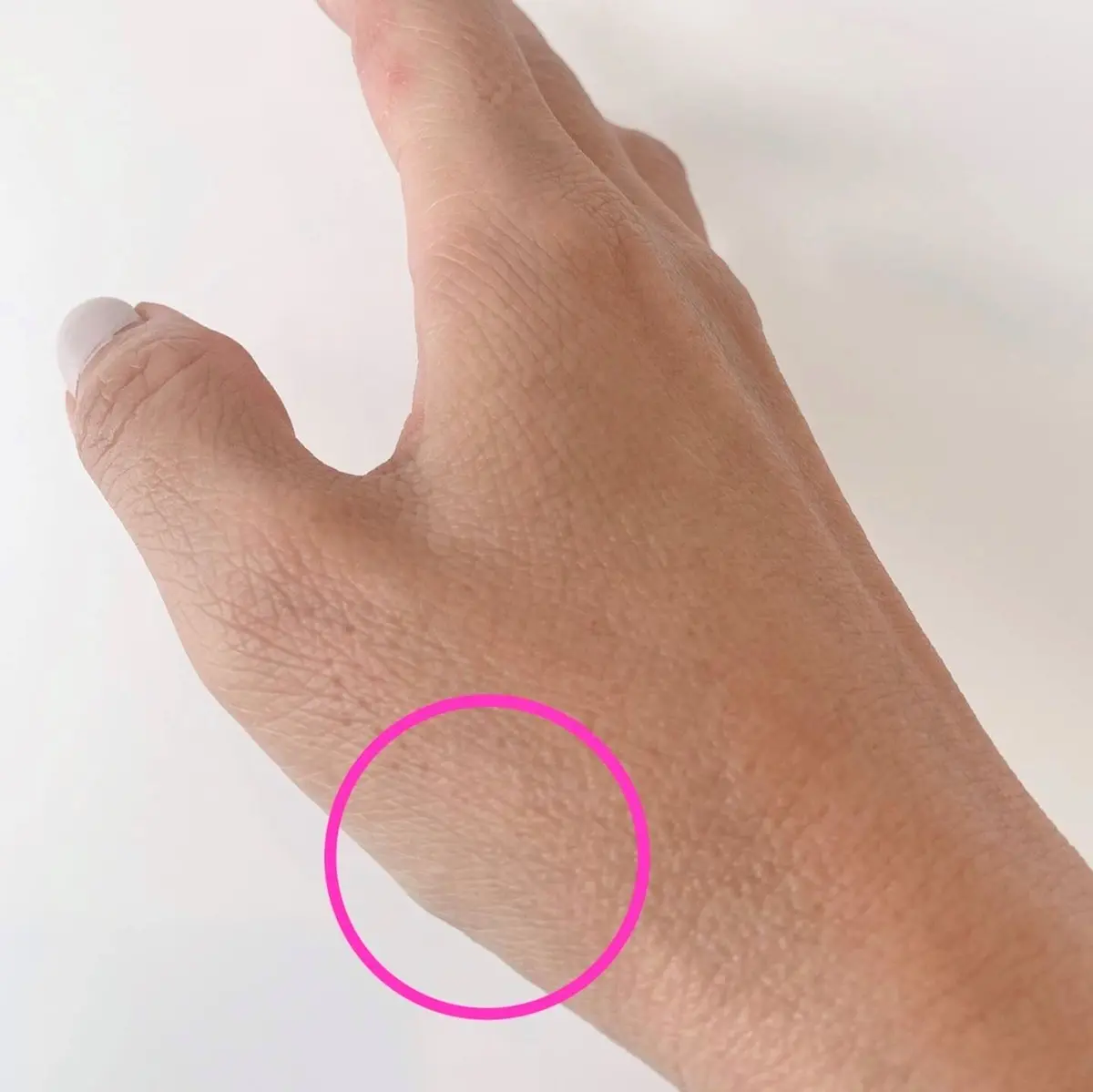 ここが母指CM関節。今まであまり意識していなかったけれど、確かにペットボトルの蓋を開けるとき、このあたりに鈍痛が……。