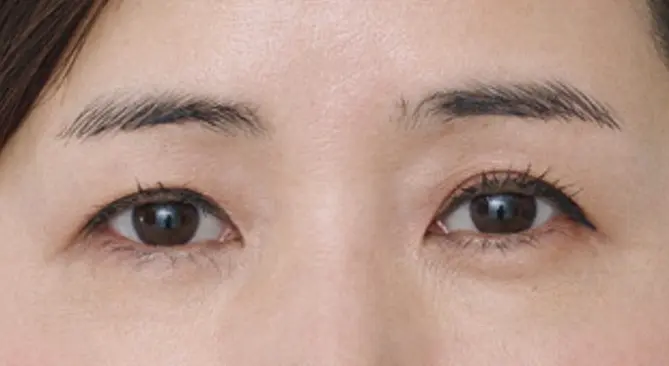 藤井優美さん（ビューティエディター）の美眉メソッド　メイク前の写真