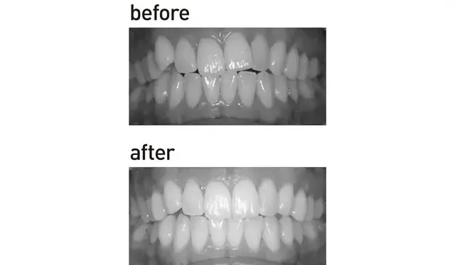 【大人の「歯の見た目」メンテナンスまとめの画像_18