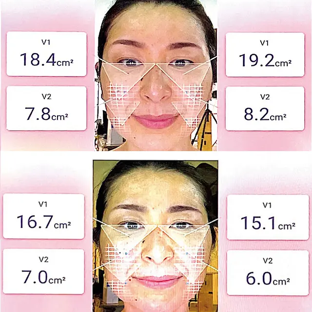 ハイミラーで測定