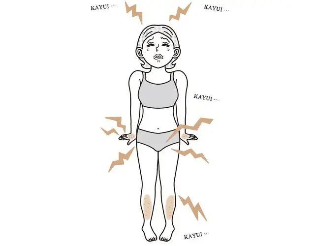 更年期世代に増える「かゆみ」の原因