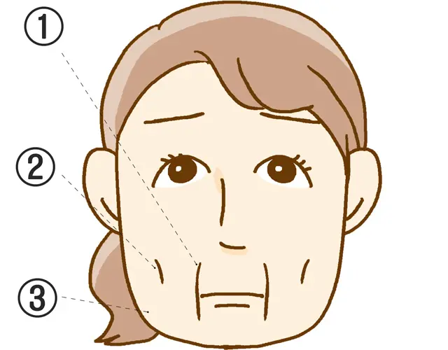 ヤギだるみのポイント