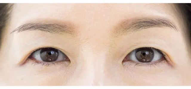 《ノーライン》