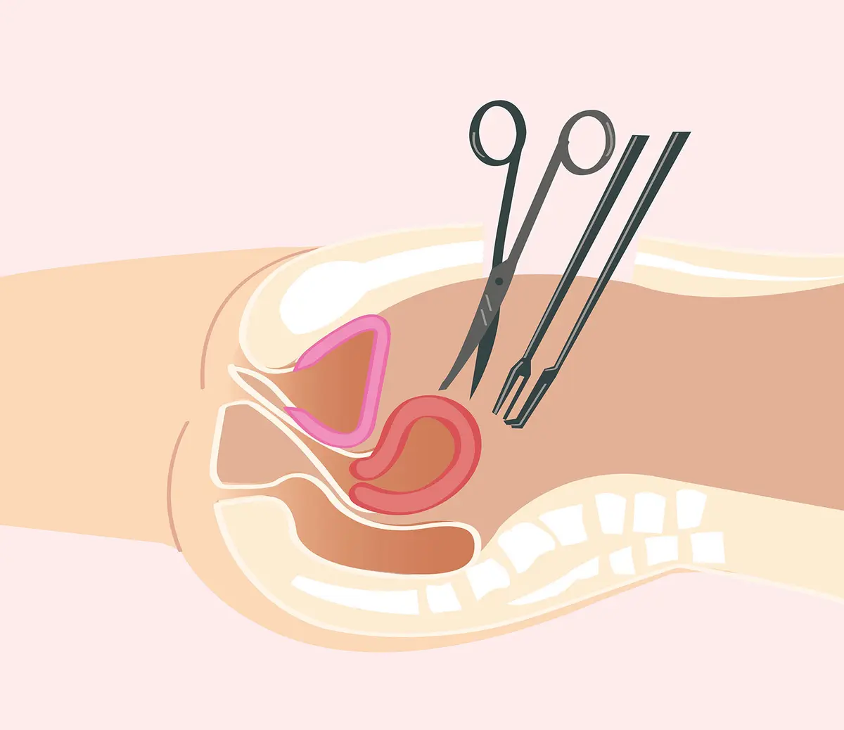 OurAge×Webエクラ　開腹手術