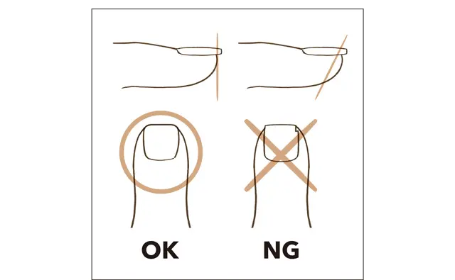 指の先端から爪がはみ出さないギリギリの長さにカット。短く切りすぎるのはNG。角を切りすぎると化膿する原因になるので避けて