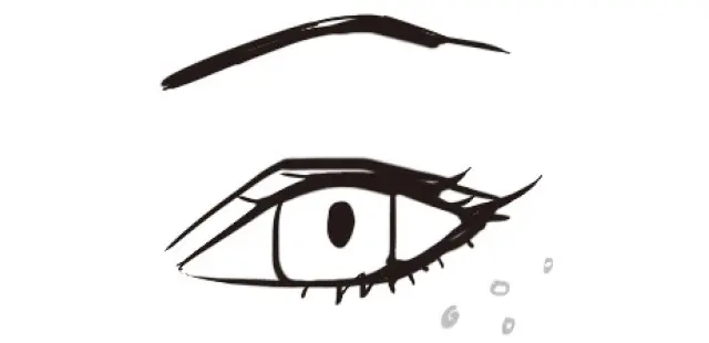 ポツポツとした白い粒状の「稗粒腫（ひりゅうしゅ）」