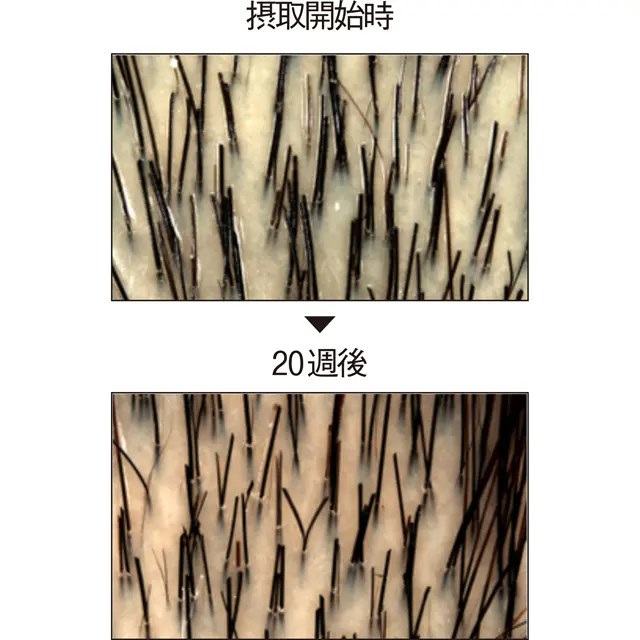 メロン果汁濃縮物を含む試験品を20週連続摂取した46歳女性の結果。