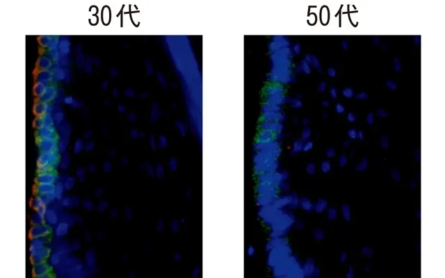 50代と30代の頭皮