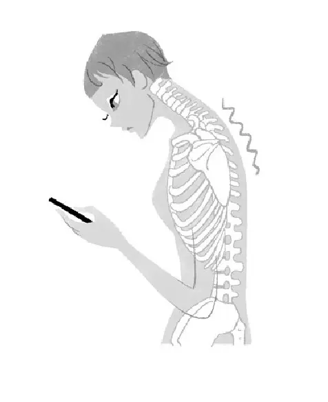 急増中の「スマホ首」は危険がいっぱい！　の画像_2