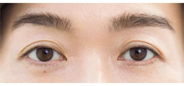 《ノーライン》