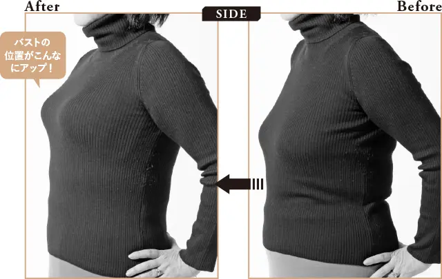 補整下着を着用したSさんのBeforeとAfter