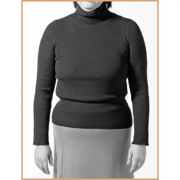 補整下着を着用する前のSさんのフロントスタイル