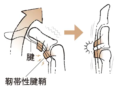 1. 指を伸ばすとばねのように戻る “ばの画像_1