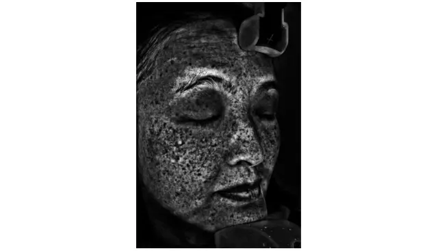 【美容クリニックでシミとり】基本を知っての画像_3