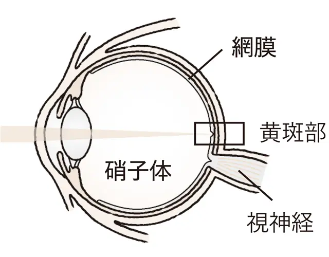 視野の中心・黄斑部で起きる加齢トラブル