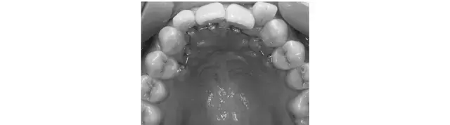 【大人の「歯の見た目」メンテナンスまとめの画像_13