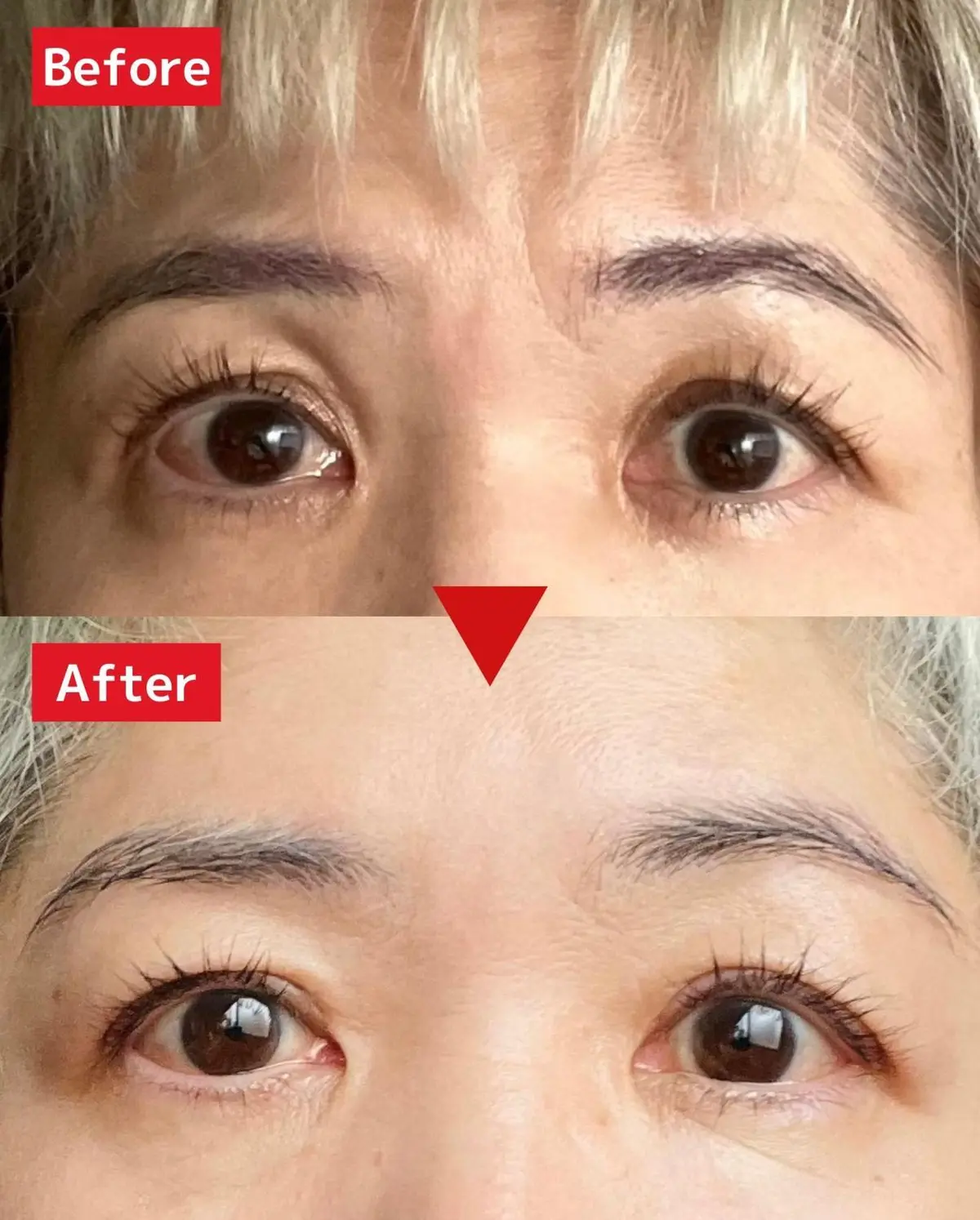 OurAge×Webエクラ　Befoer After