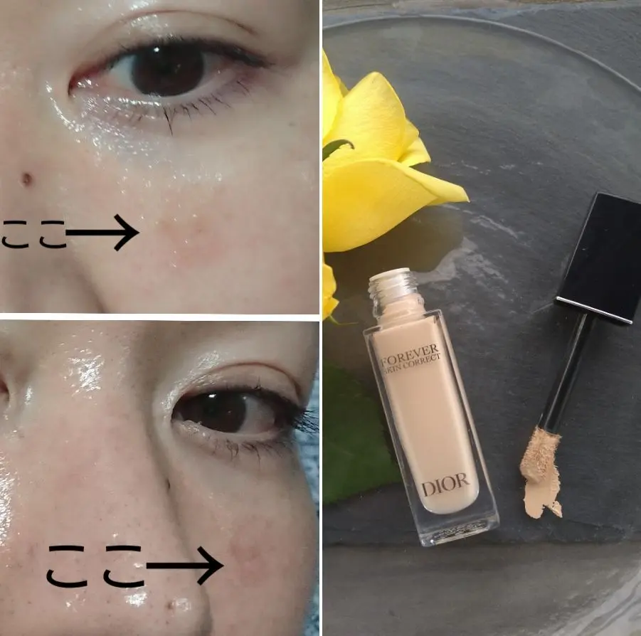 頬のシミとディオールコンシーラー