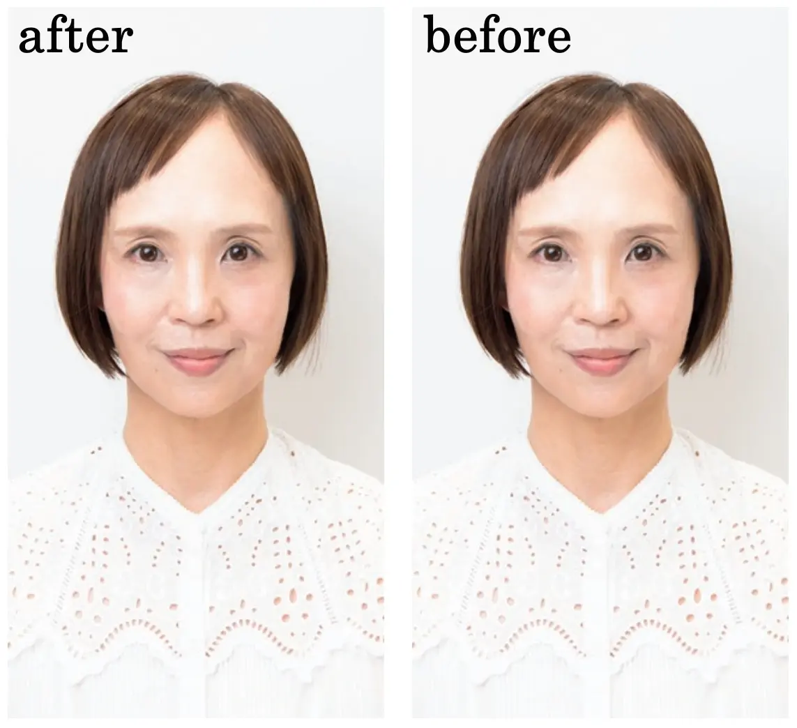 AFLOAT RUVUAの『ヘアループ』を実際に装着したビフォーアフター写真