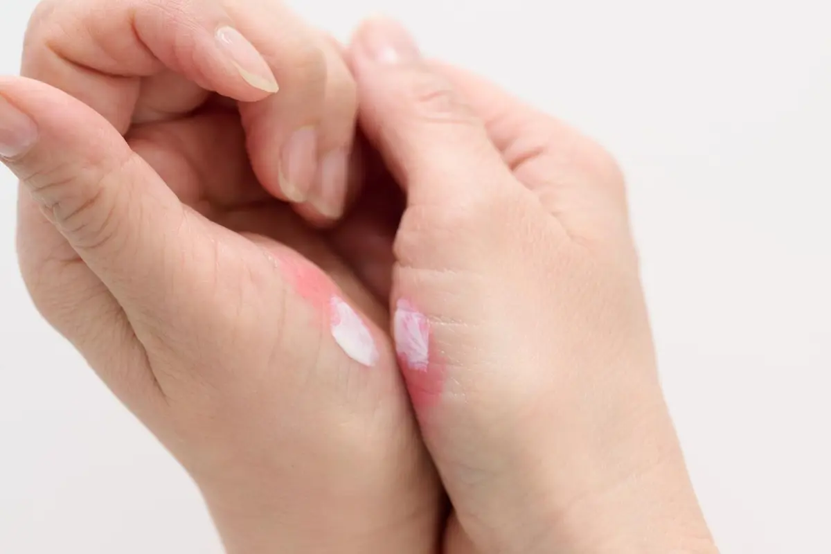 OurAge×Webエクラ 50代チーク塗り方 シミ予防 手の母指球で、クリームチークとデイクリームを混ぜます