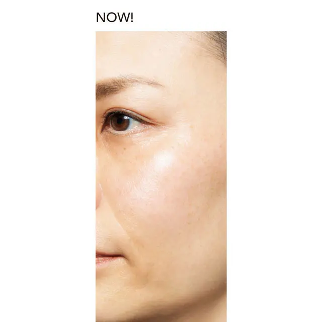 《2年経って現在》最新のセルフケアでより透明感