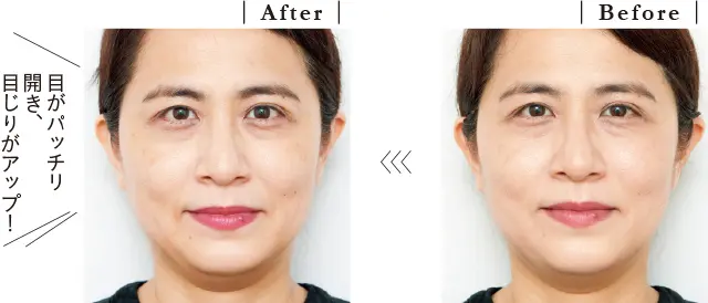 施術前と施術後
