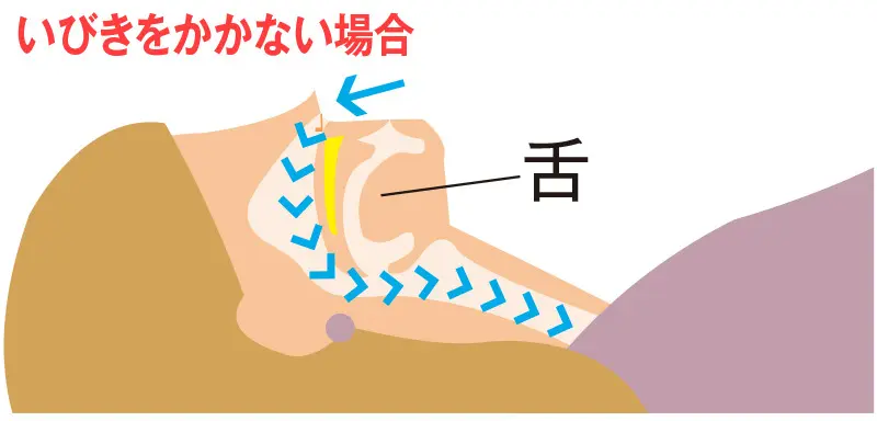 OurAge×Webエクラ　いびきをかかない場合／気道が確保されていると、空気がスムーズに通るのでいびきはかきません
