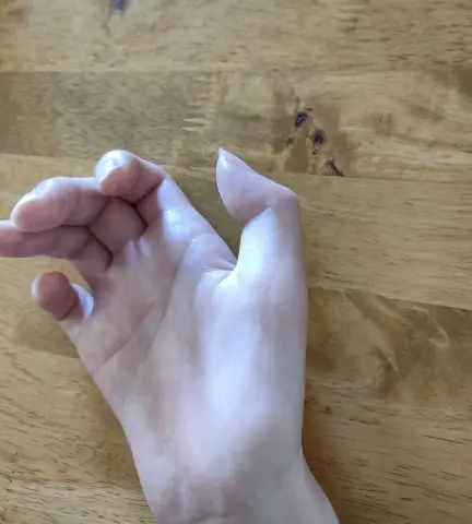 私の右手。これ以上は自力で指先が伸びません。左に至ってはほぼ動かない。