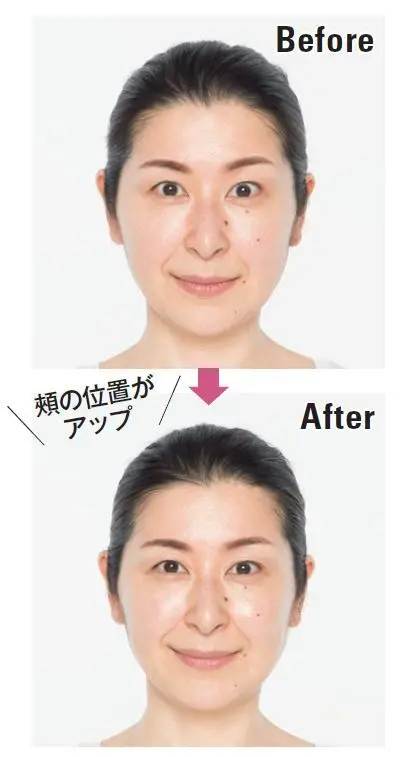 デンキバリブラシ