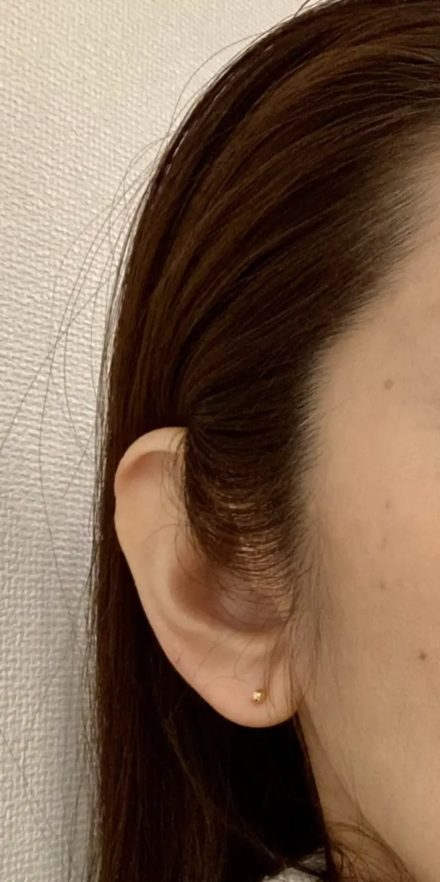 美容クリニックでピアスを開けました。ファーストピアスはワンポイントピアス。