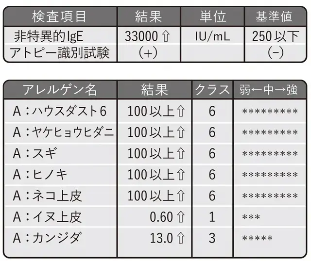 血液を採取してIgE抗体の値を見る