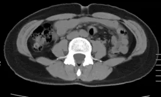 OurAge×Webエクラ　BEFORE -2
