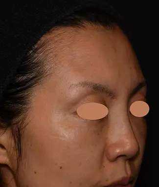 OurAge×Webエクラ  40代女性AFTER