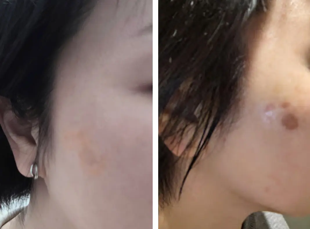 シレッとシミメンテ！お正月休みで大成功♡の画像_1