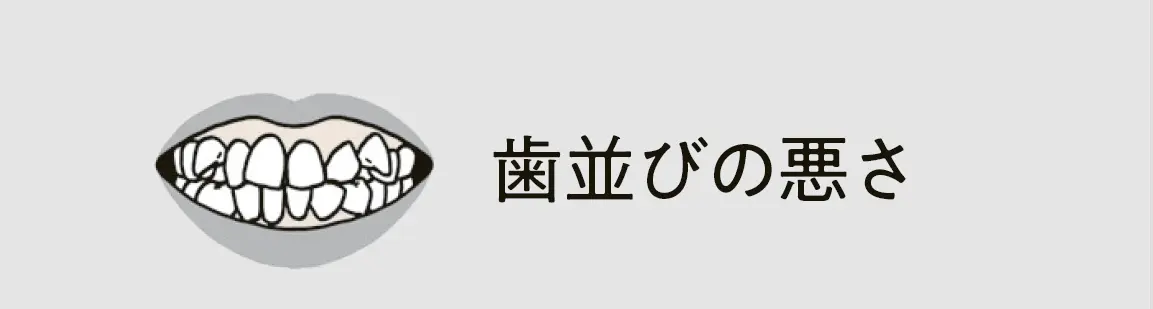 50代　歯並びの悪さ　原因　イラスト