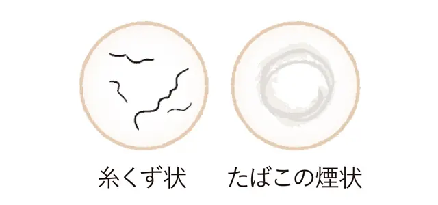 硝子体の老化によって、こんなものが見える！