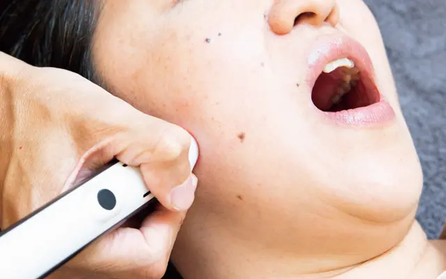 『代官山 山口整骨院』小顔（顔輪郭）治療（30分）＋高性能光治療リフトアップ（10分）