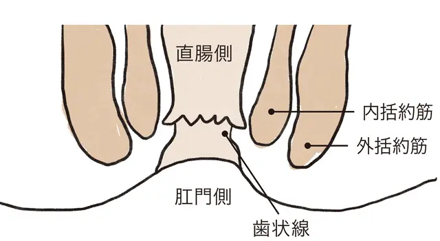 裂肛（切れ痔）