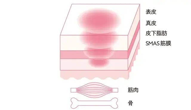 老け見えの原因は「たるみ毛穴」!? 50の画像_37