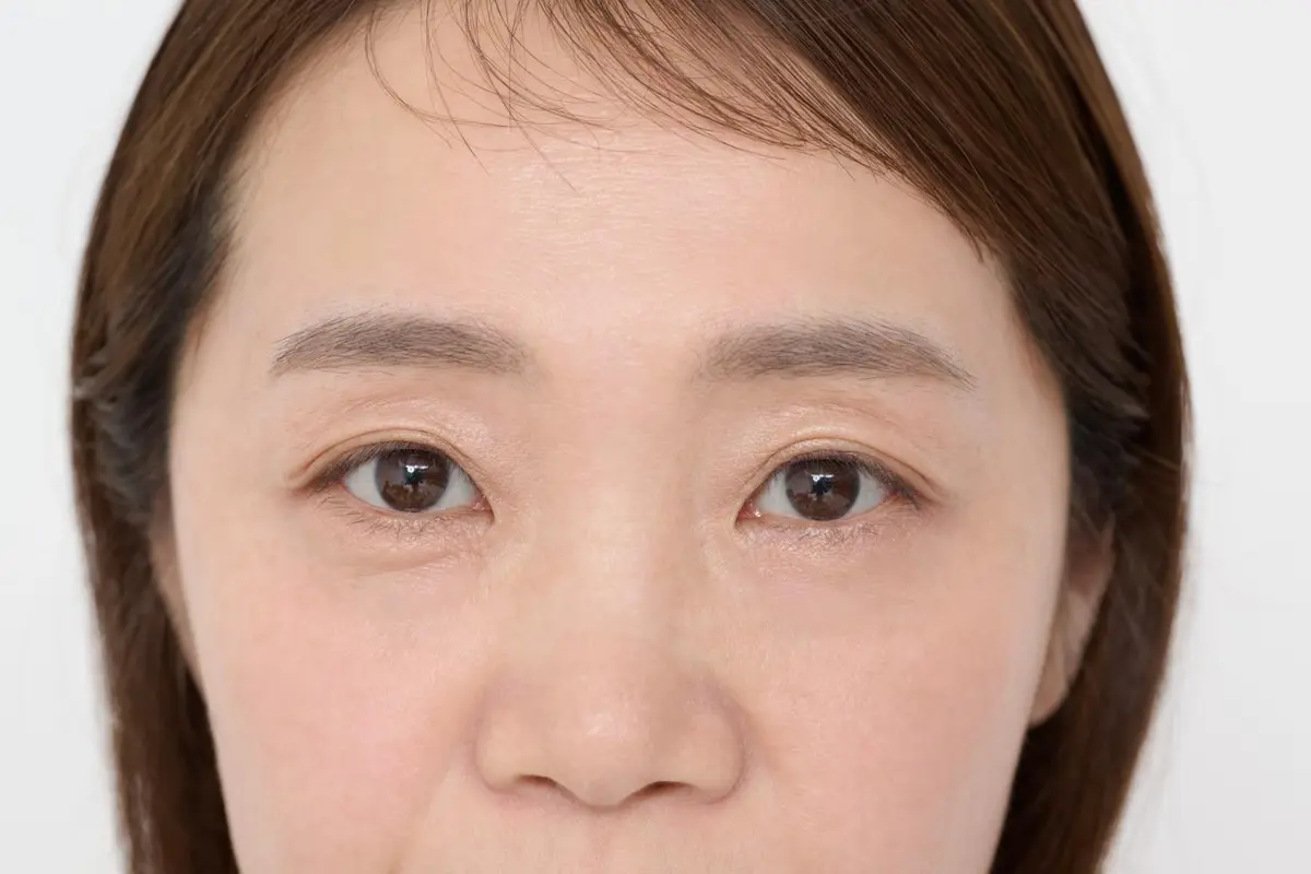 OurAge×Webエクラ　●After アイシャドウをつけたあとの顔