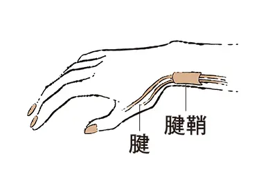 更年期の手指問題