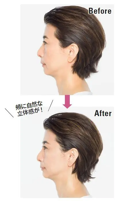 頰に自然な 立体感が！