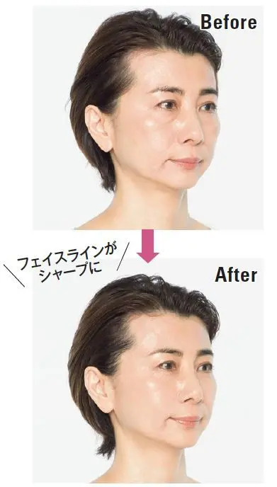 フェイスライン