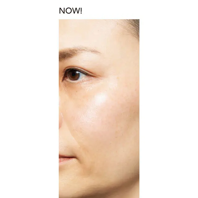 現在の肌の様子