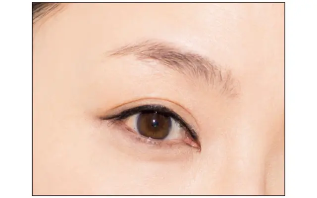 黒目の上の粘膜が埋まっているか確認