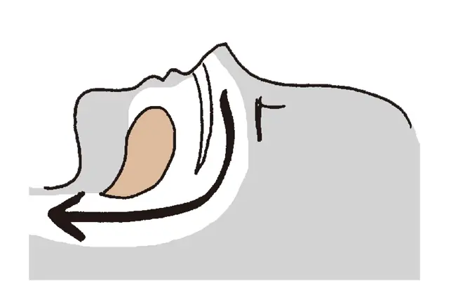 舌やのどの筋緊張低下がいびきを起こすメカニズム