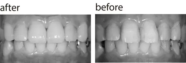 【大人の「歯の見た目」メンテナンスまとめの画像_4